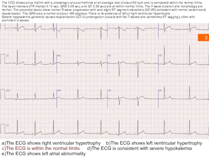 3 a)The ECG shows right ventricular hypertrophy b)The ECG shows left