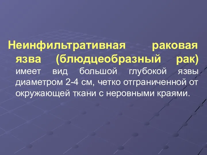 Неинфильтративная раковая язва (блюдцеобразный рак) имеет вид большой глубокой язвы диаметром