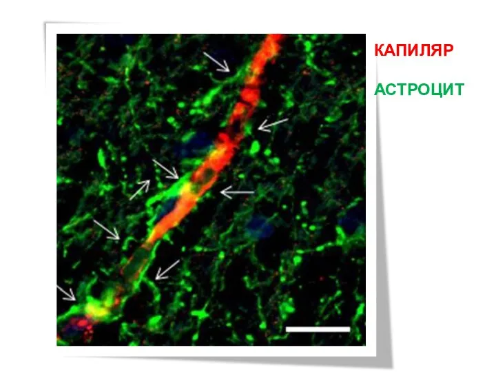 КАПИЛЯР АСТРОЦИТ