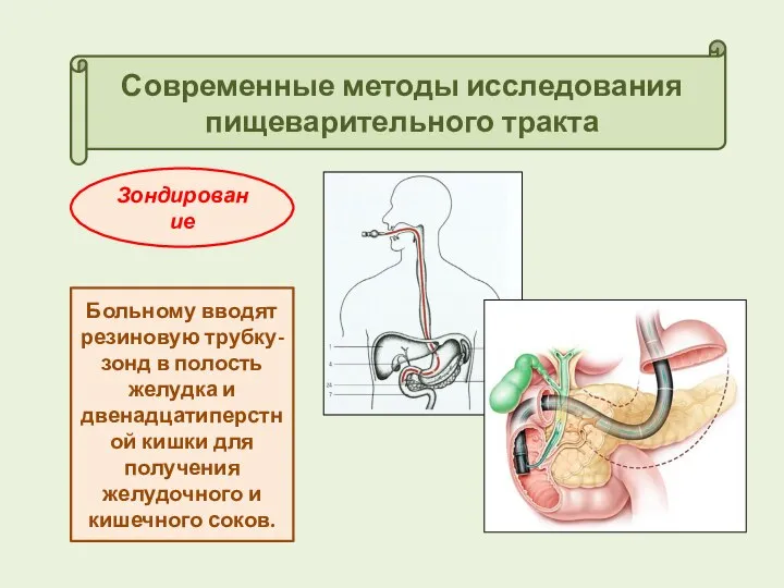 Современные методы исследования пищеварительного тракта Зондирование Больному вводят резиновую трубку-зонд в