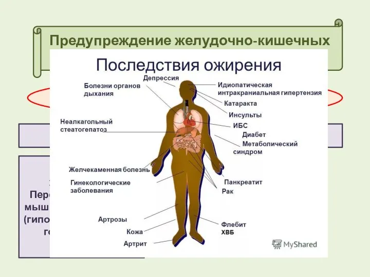 Предупреждение желудочно-кишечных заболеваний НАРУШЕНИЯ ОБМЕНА ВЕЩСТВ (дистрофия: ожирение, истощение) ПРИЧИНЫ 1.