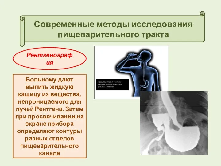 Современные методы исследования пищеварительного тракта Рентгенография Больному дают выпить жидкую кашицу