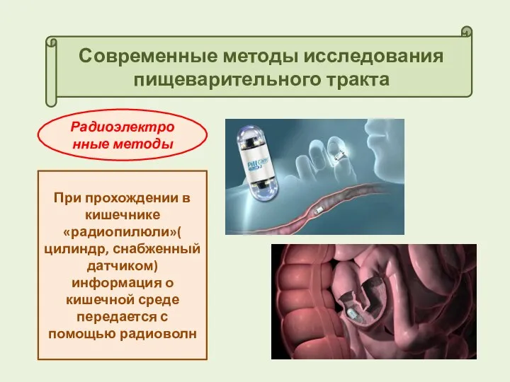 Современные методы исследования пищеварительного тракта Радиоэлектронные методы При прохождении в кишечнике