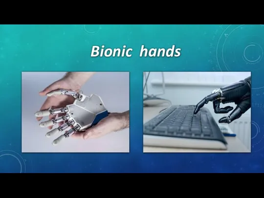 Bionic hands