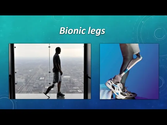 Bionic legs