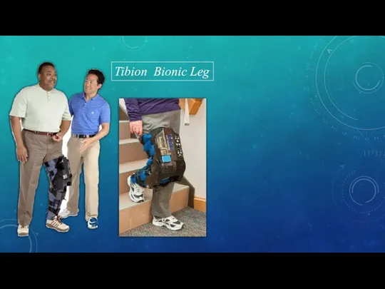 Tibion Bionic Leg