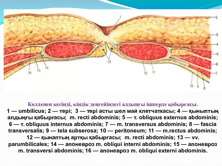 Көлденең кесінді, кіндік деңгейіндегі алдыңғы ішперде қабырғасы. 1 — umbilicus; 2