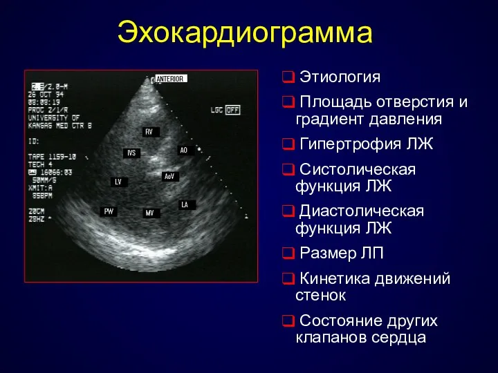 Эхокардиограмма Этиология Площадь отверстия и градиент давления Гипертрофия ЛЖ Систолическая функция