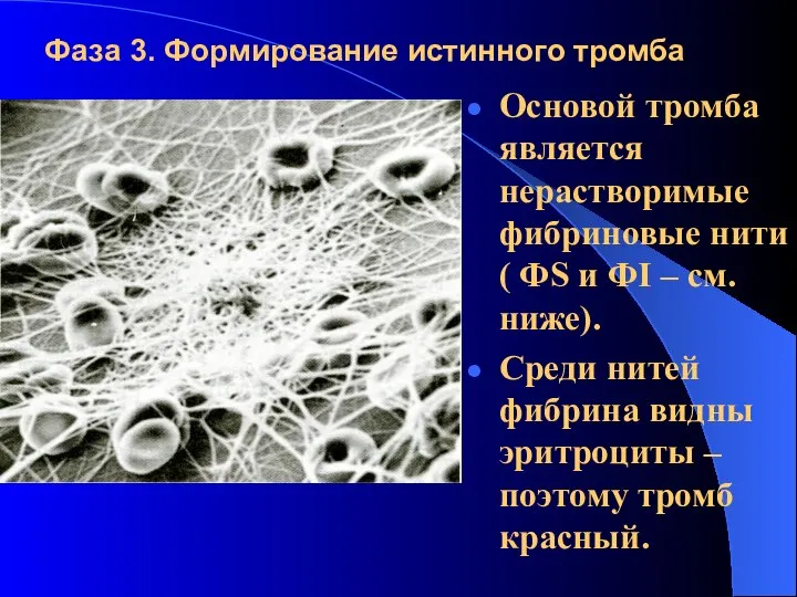 Фаза 3. Формирование истинного тромба Основой тромба является нерастворимые фибриновые нити