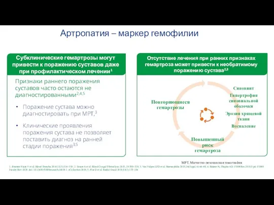 Артропатия – маркер гемофилии Признаки раннего поражения суставов часто остаются не