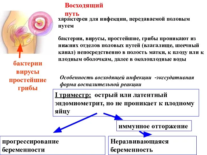 Восходящий путь характерен для инфекции, передаваемой половым путем бактерии, вирусы, простейшие,