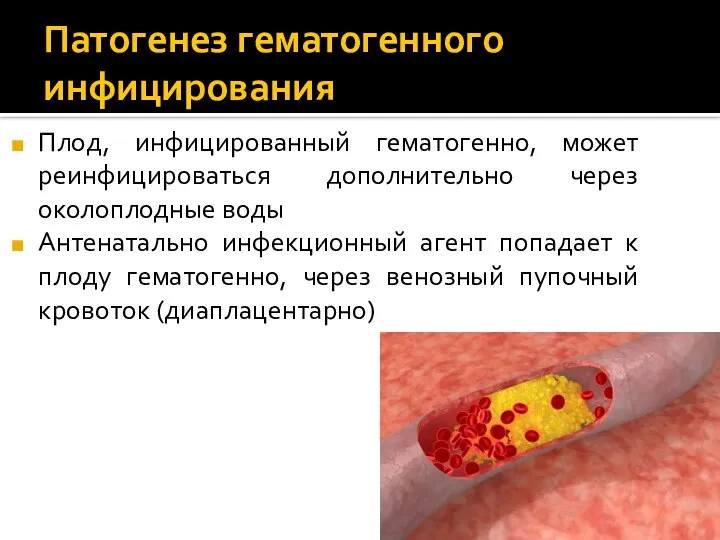 Патогенез гематогенного инфицирования Плод, инфицированный гематогенно, может реинфицироваться дополнительно через околоплодные