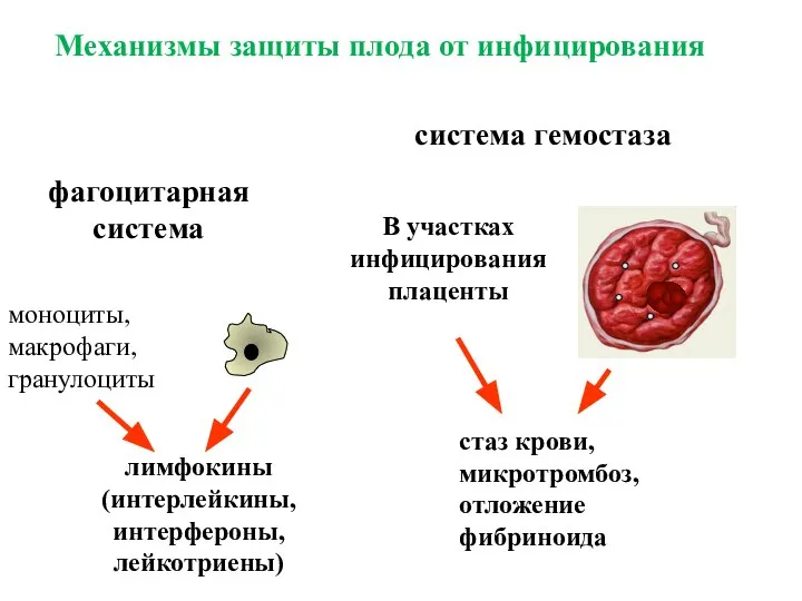 Механизмы защиты плода от инфицирования фагоцитарная система моноциты, макрофаги, гранулоциты лимфокины