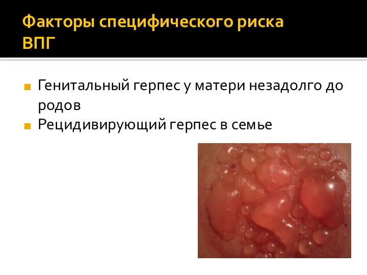 Факторы специфического риска ВПГ Генитальный герпес у матери незадолго до родов Рецидивирующий герпес в семье