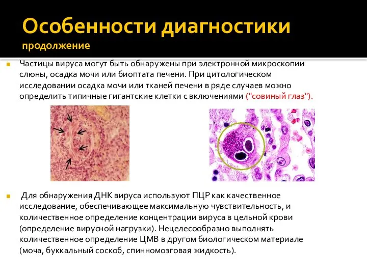 Особенности диагностики продолжение Частицы вируса могут быть обнаружены при электронной микроскопии