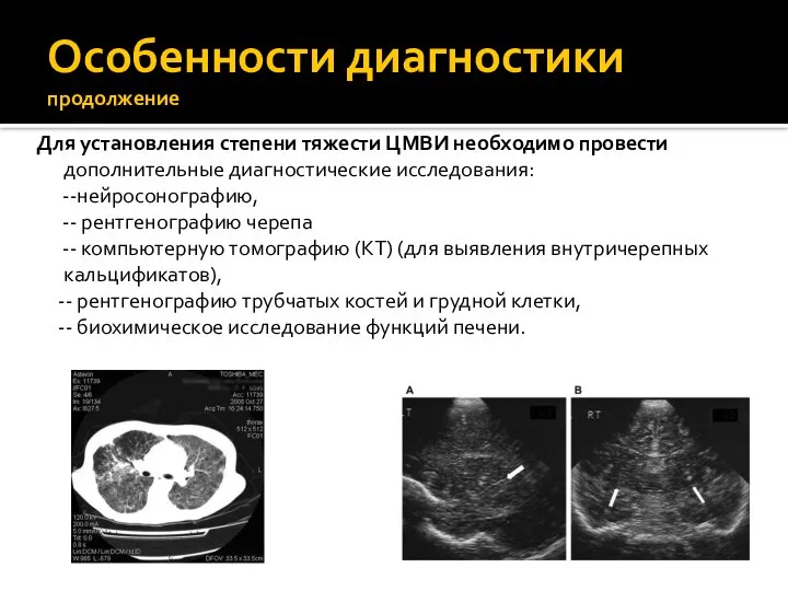 Особенности диагностики продолжение Для установления степени тяжести ЦМВИ необходимо провести дополнительные