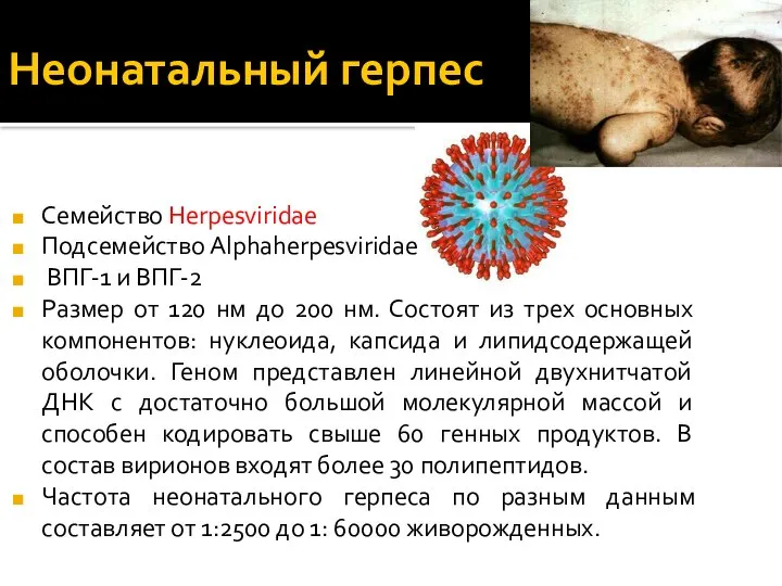 Неонатальный герпес Семейство Herpesviridae Подсемейство Alphaherpesviridae ВПГ-1 и ВПГ-2 Размер от