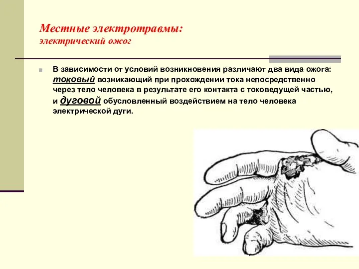 Местные электротравмы: электрический ожог В зависимости от условий возникновения различают два