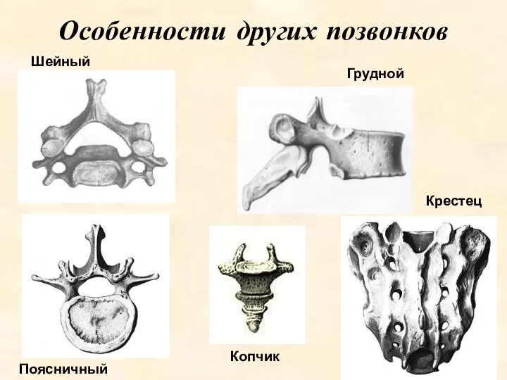 Особенности других позвонков Шейный Грудной Поясничный Копчик Крестец