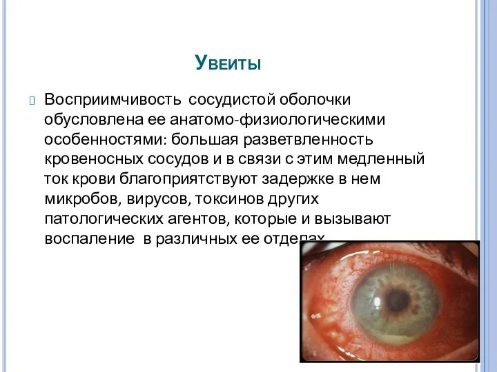 Увеиты Восприимчивость сосудистой оболочки обусловлена ее анатомо-физиологическими особенностями: большая разветвленность кровеносных