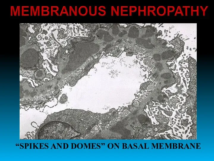 “SPIKES AND DOMES” ON BASAL MEMBRANE