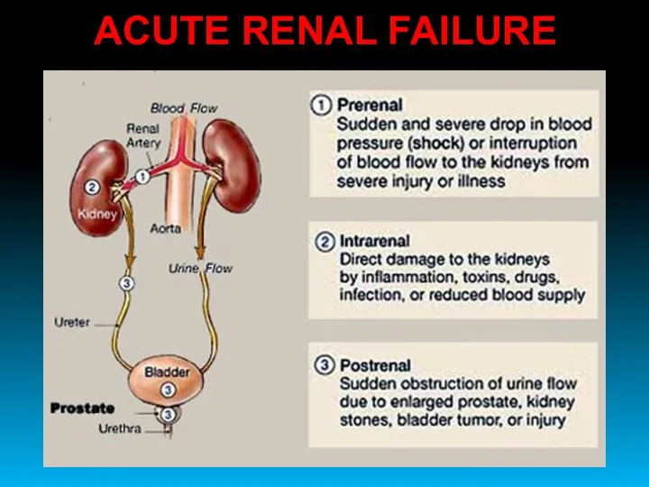 ACUTE RENAL FAILURE