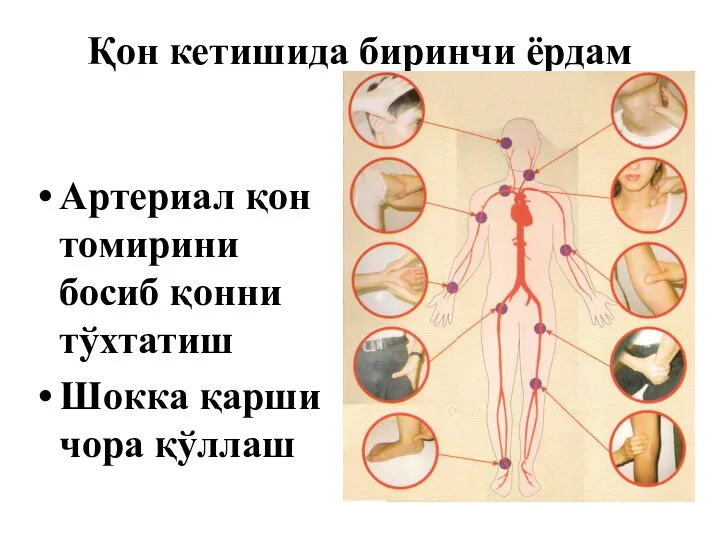 Қон кетишида биринчи ёрдам Артериал қон томирини босиб қонни тўхтатиш Шокка қарши чора қўллаш