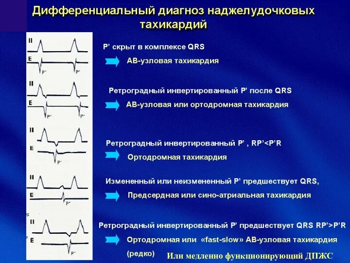 Или медленно функционирующий ДПЖС