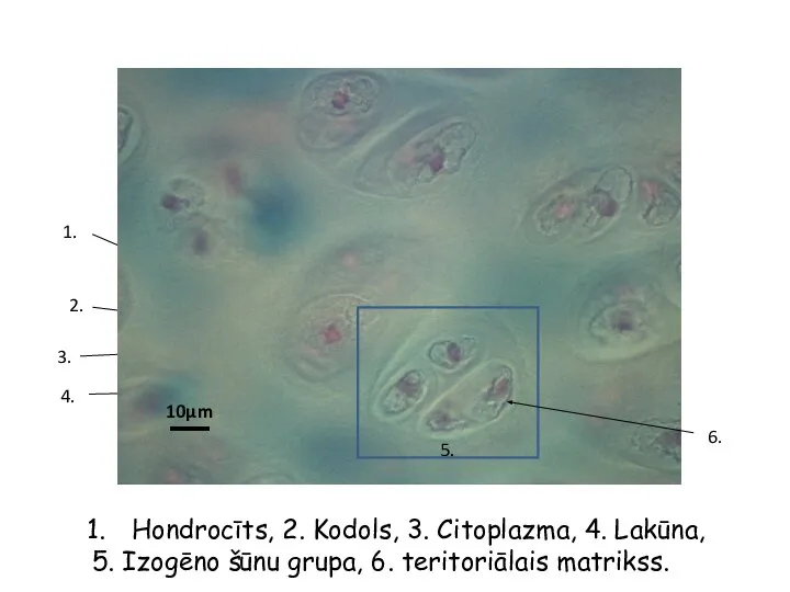 Hondrocīts, 2. Kodols, 3. Citoplazma, 4. Lakūna, 5. Izogēno šūnu grupa,