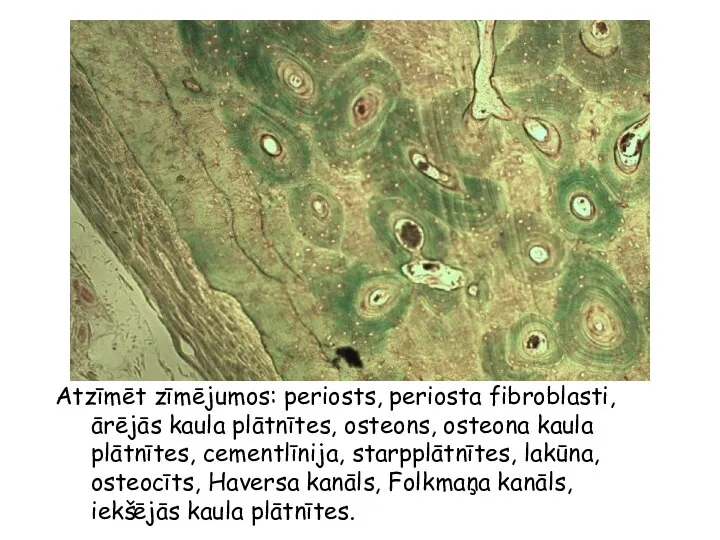 Atzīmēt zīmējumos: periosts, periosta fibroblasti, ārējās kaula plātnītes, osteons, osteona kaula