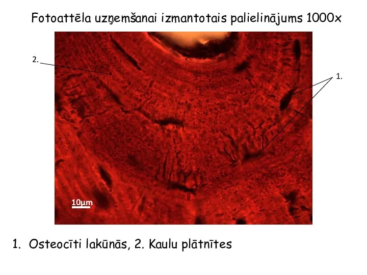 Fotoattēla uzņemšanai izmantotais palielinājums 1000x 1. 2. Osteocīti lakūnās, 2. Kaulu plātnītes 10µm