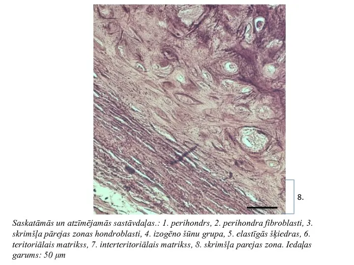 Saskatāmās un atzīmējamās sastāvdaļas.: 1. perihondrs, 2. perihondra fibroblasti, 3. skrimšļa