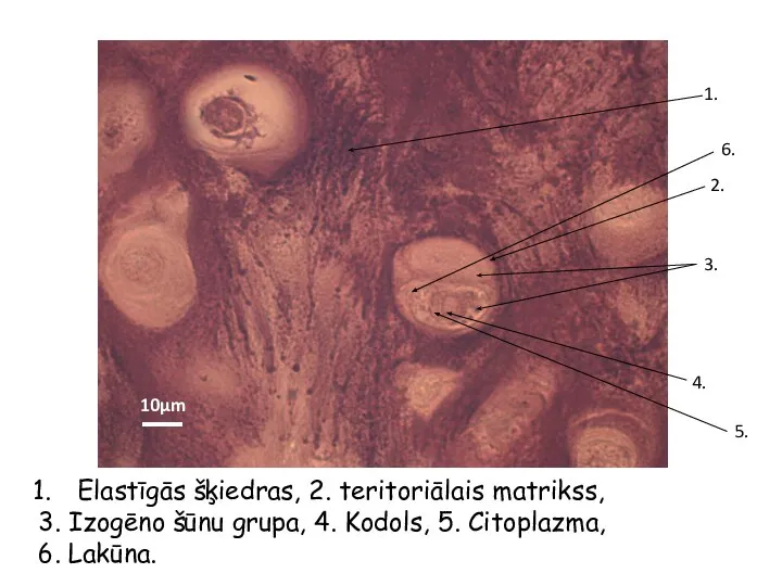 Elastīgās šķiedras, 2. teritoriālais matrikss, 3. Izogēno šūnu grupa, 4. Kodols, 5. Citoplazma, 6. Lakūna.