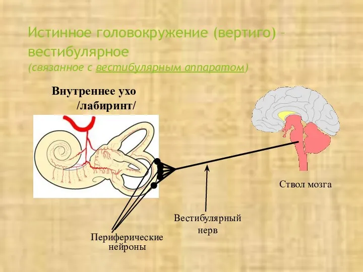 Истинное головокружение (вертиго) – вестибулярное (связанное с вестибулярным аппаратом) Внутреннее ухо