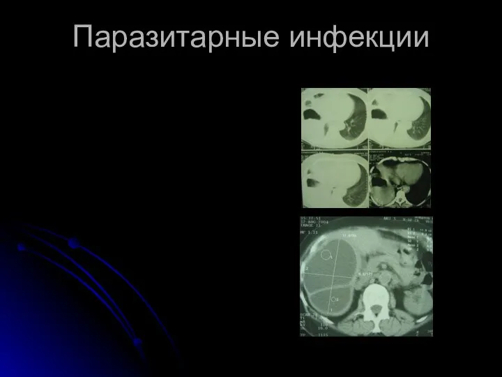 Паразитарные инфекции