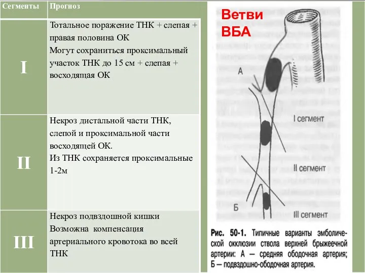 Ветви ВБА