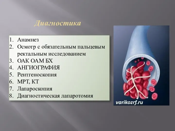 Диагностика Анамнез Осмотр с обязательным пальцевым ректальным исследованием ОАК ОАМ БХ