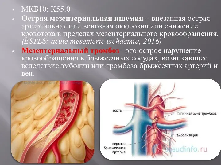 МКБ10: K55.0 Острая мезентериальная ишемия – внезапная острая артериальная или венозная