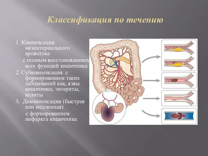 Классификация по течению 1. Компенсация мезентериального кровотока с полным восстановлением всех