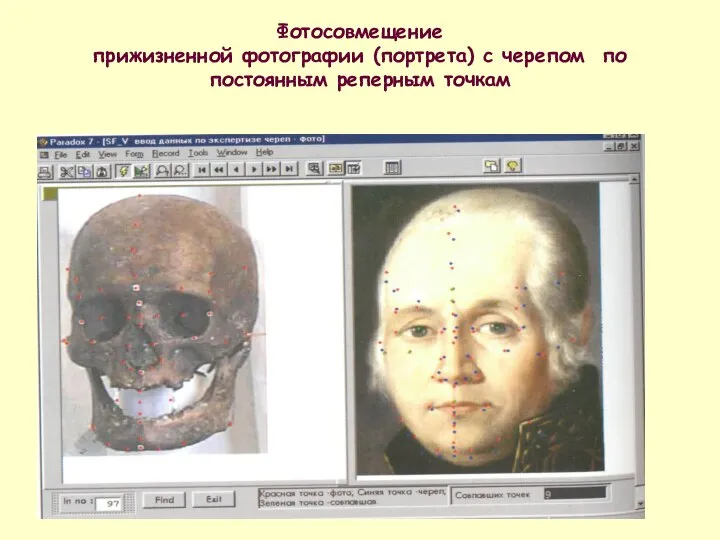 Фотосовмещение прижизненной фотографии (портрета) с черепом по постоянным реперным точкам