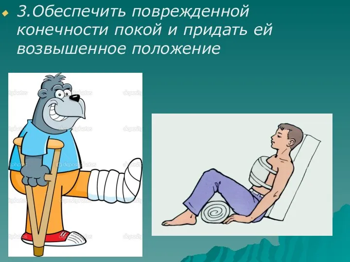 3.Обеспечить поврежденной конечности покой и придать ей возвышенное положение