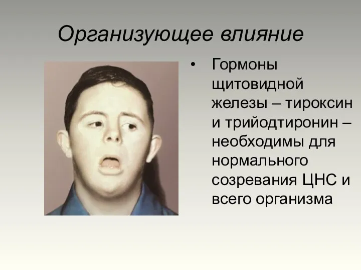 Организующее влияние Гормоны щитовидной железы – тироксин и трийодтиронин – необходимы