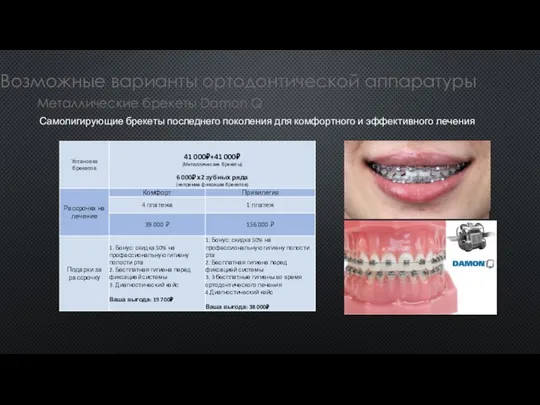 Возможные варианты ортодонтической аппаратуры Металлические брекеты Damon Q Самолигирующие брекеты последнего