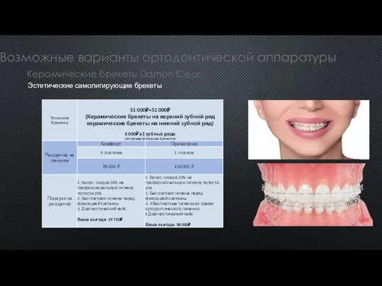 Возможные варианты ортодонтической аппаратуры Керамические брекеты Damon Clear Эстетические самолигирующие брекеты