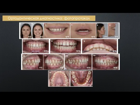 Ортодонтическая диагностика: фотопротокол