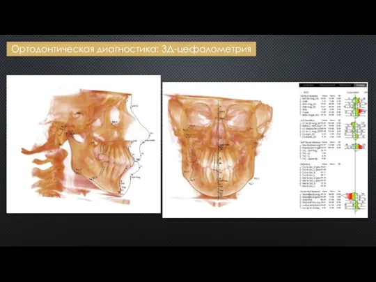 Ортодонтическая диагностика: 3Д-цефалометрия