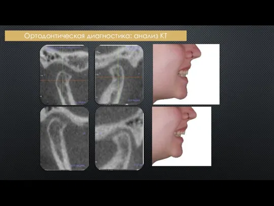 Ортодонтическая диагностика: анализ КТ