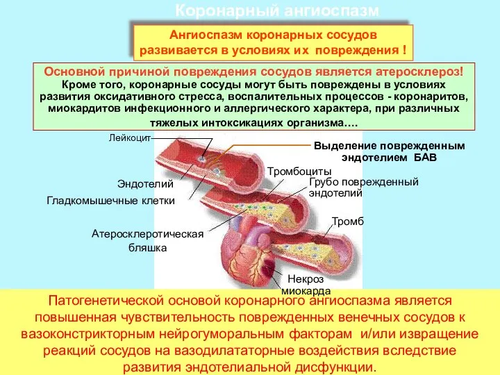 Коронарный ангиоспазм Ангиоспазм коронарных сосудов развивается в условиях их повреждения !