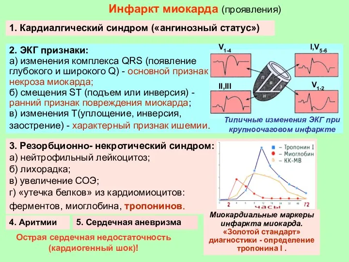 Инфаркт миокарда (проявления) 1. Кардиалгический синдром («ангинозный статус») 2. ЭКГ признаки: