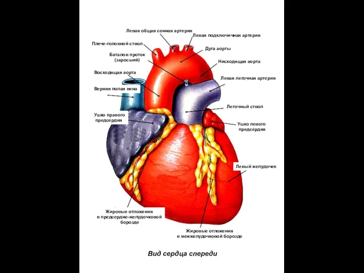 Дуга аорты Плече-головной ствол Нисходящая аорта Левая легочная артерия Восходящая аорта